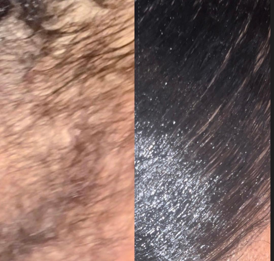 BEFORE & AFTER RESULTS